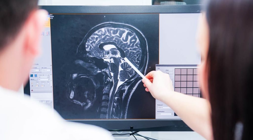 can covid cause brain injuries?